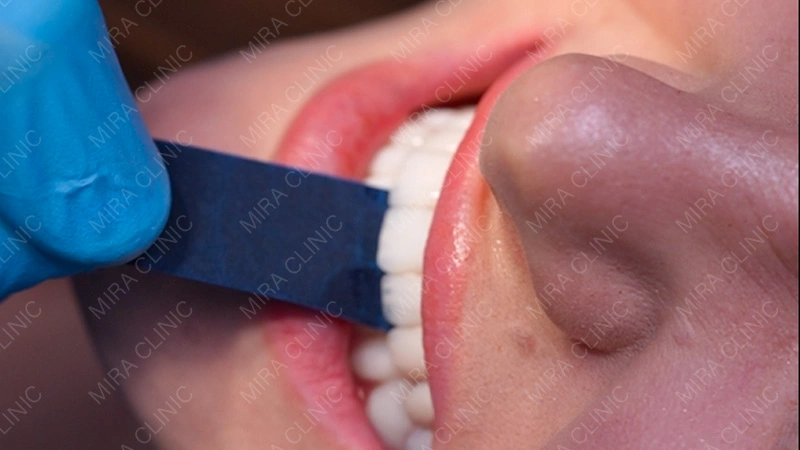 celebrity dental care